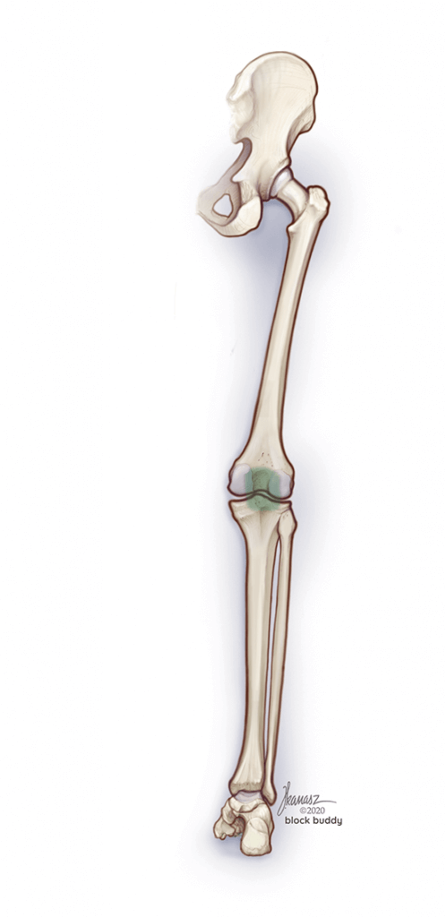 05_1a-Popliteal-osteotome-LG-497x1024 iPACK Block Shaded Area Illustration Skeletal View From Back