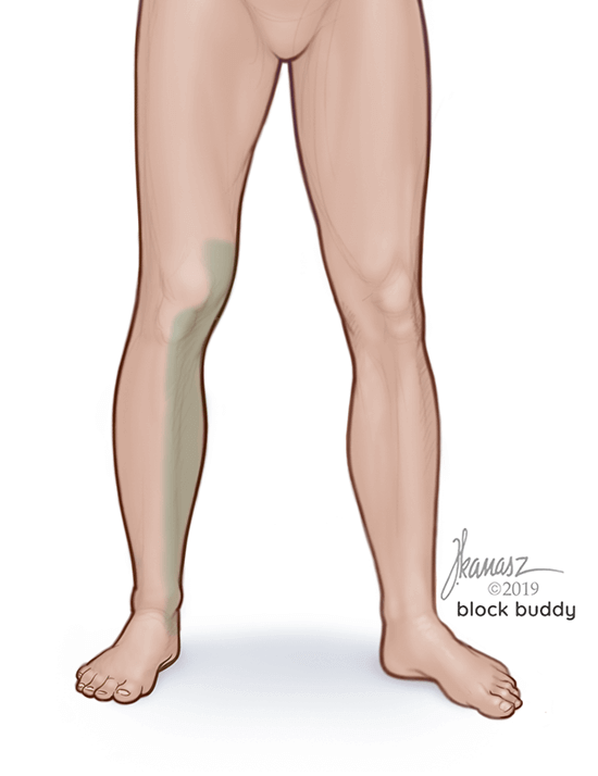 1-Adductor-canal-area-LG_Edit Adductor Canal Block Shaded Area Illustration