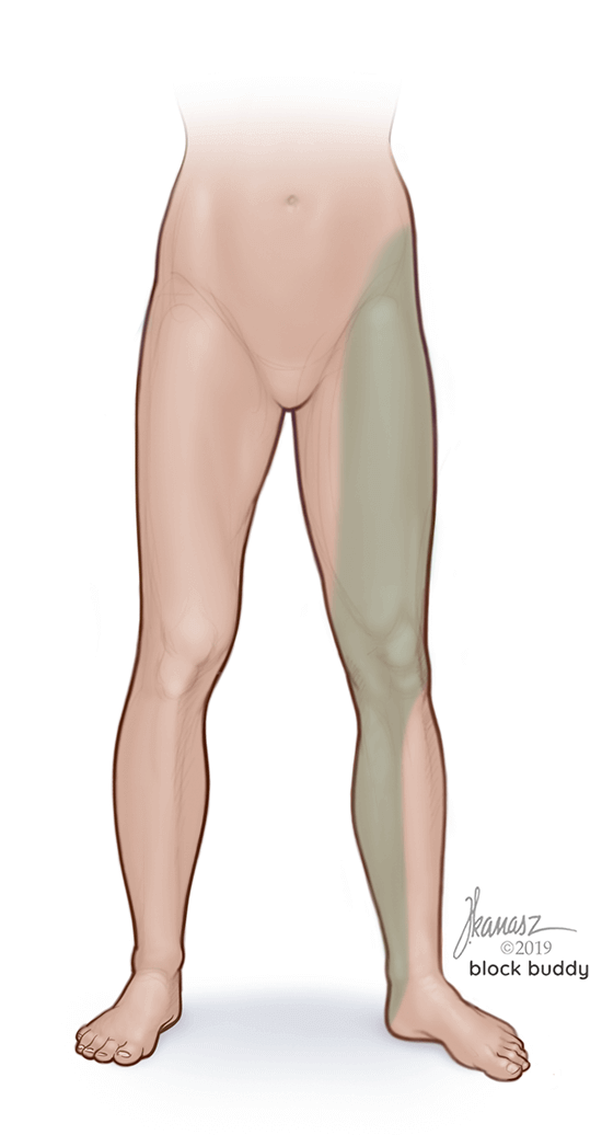 1-Fascia-iliaca-block-area-LG Fascia Iliaca Block Shaded Area Illustration