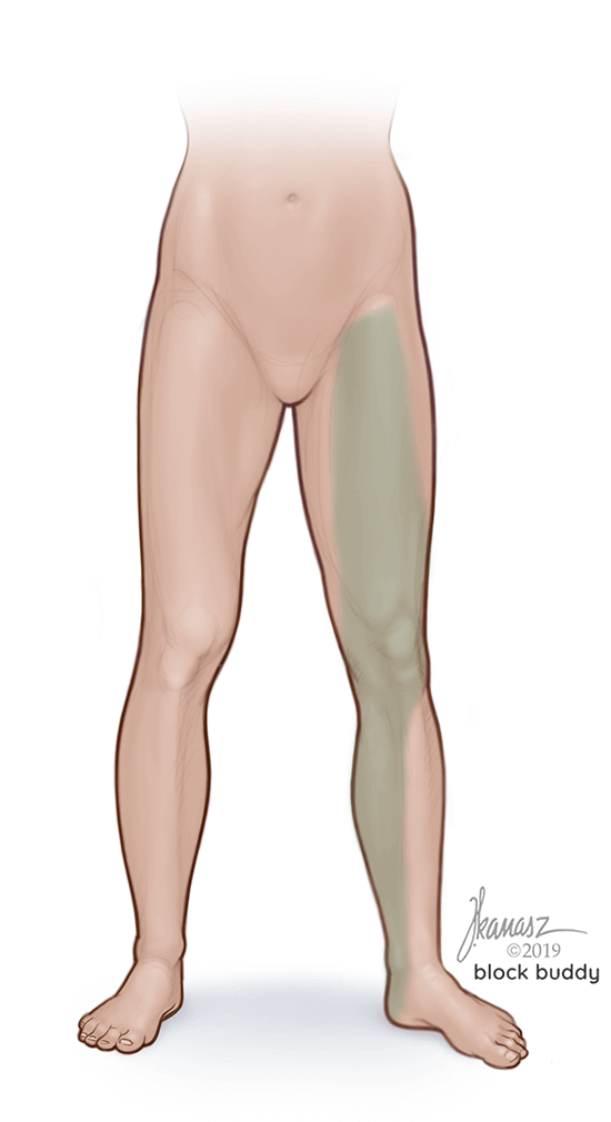 1-Femoral-nerve-area-LG Femoral Nerve Block Shaded Area Illustration