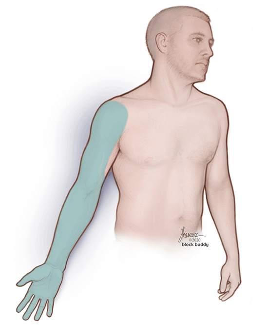 1-Supraclavicular-blockSkin-REVISED-SM Supraclavicular Block Shaded Area Illustration