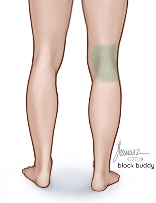 1-iPACK-area-LG_edit iPACK Block Shaded Area Illustration