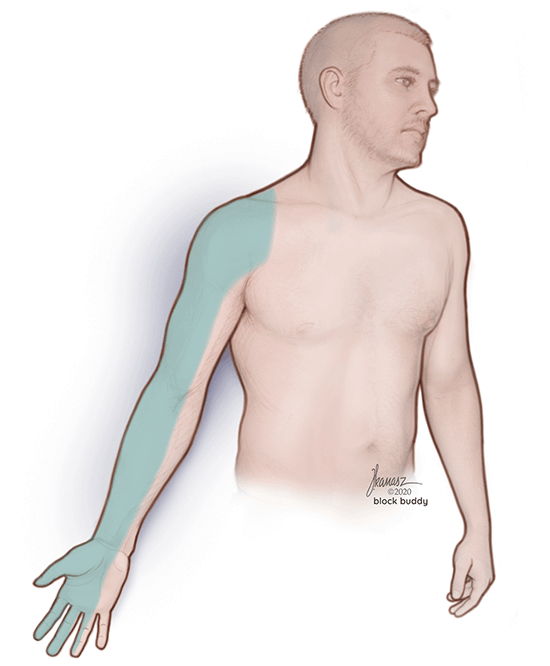1-interscalene-block-area-REVISED-SM Interscalene Block Shaded Area Illustration