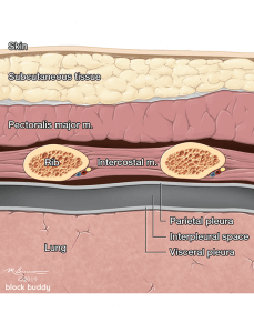 15-Lung-Ultrasound-Anatomy-Collapsed_1050x800_Final-229x300 COVID-19 Lung Ultrasound Pneumothorax Illustration