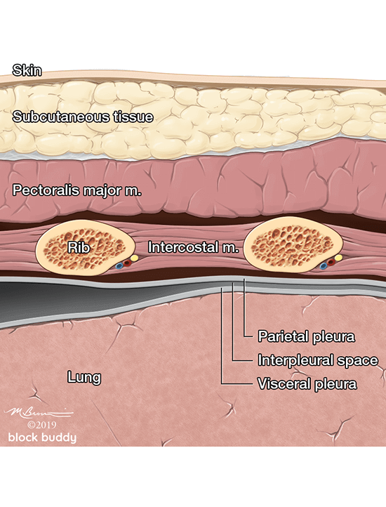18-Lung-Ultrasound-Anatomy-Lung-Point_1050x800_Final COVID-19 Lung Ultrasound Layers Illustration