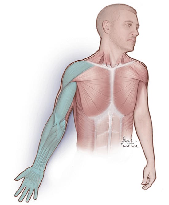 1a-Supraclavicular-block-muscle-REVISED-SM Supraclavicular Block Shaded Area Muscular Illustration