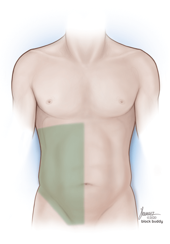 Quadratus Lumborum Block (QL3) Shaded Area Illustration