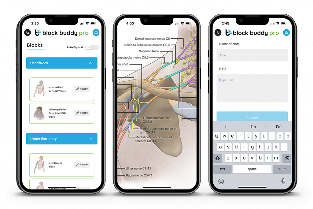BBP-1024x683-Lessons Sample Screens of the Block Buddy App for Ultrasound Guided Nerve Blocks