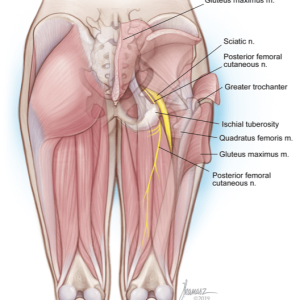 SciaticNerveBlock Sciatic Nerve Block Muscular Illustration